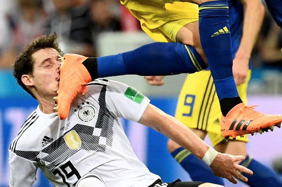 Руди травма